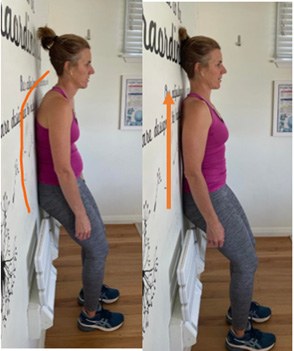Chiropractic Porirua NZ Woman With Hunch Back Results