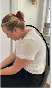 Chiropractic Porirua NZ Woman With Hunch Back